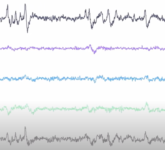 raw EEG